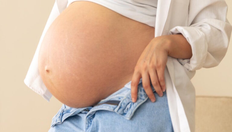 Estrias na barriga de grávida (Crédito: pvproductions/freepik)