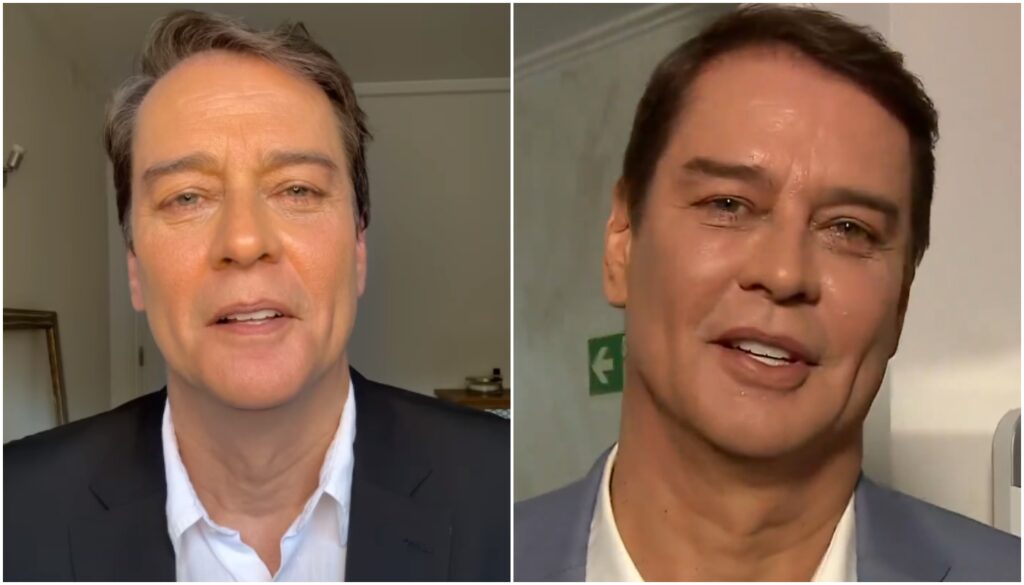 Marcello Antony harmonização facial