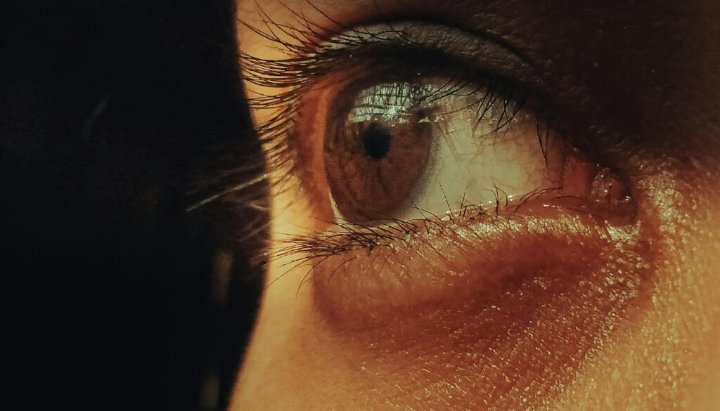 Sofre com olheiras? São esses cuidados que REALMENTE funcionam