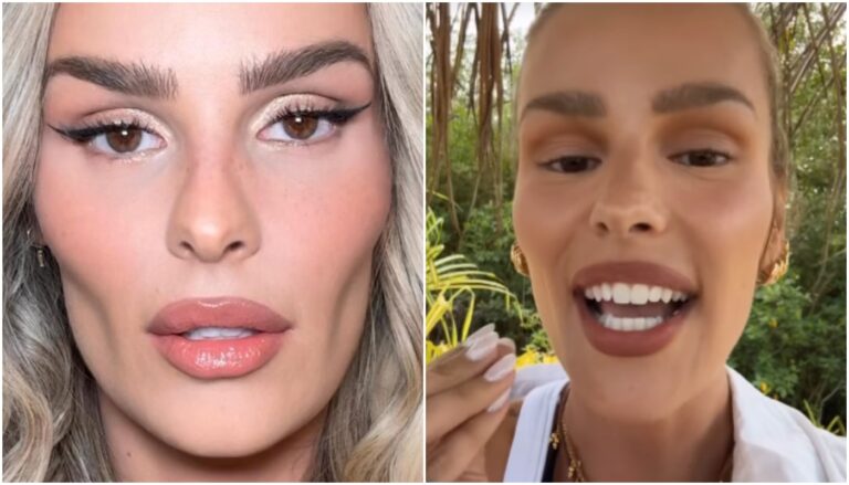 plásticas de Yasmin Brunet