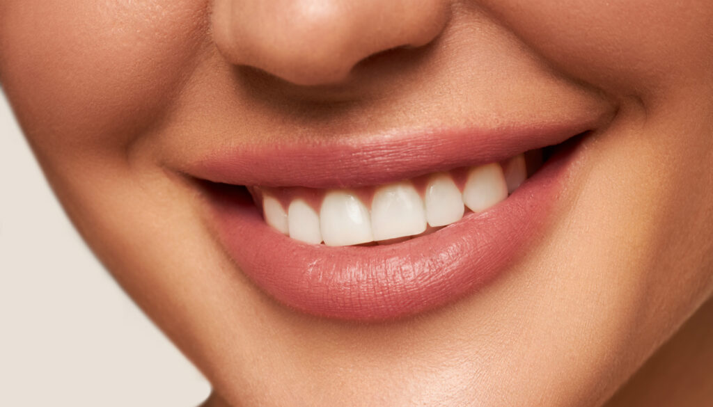 sorriso