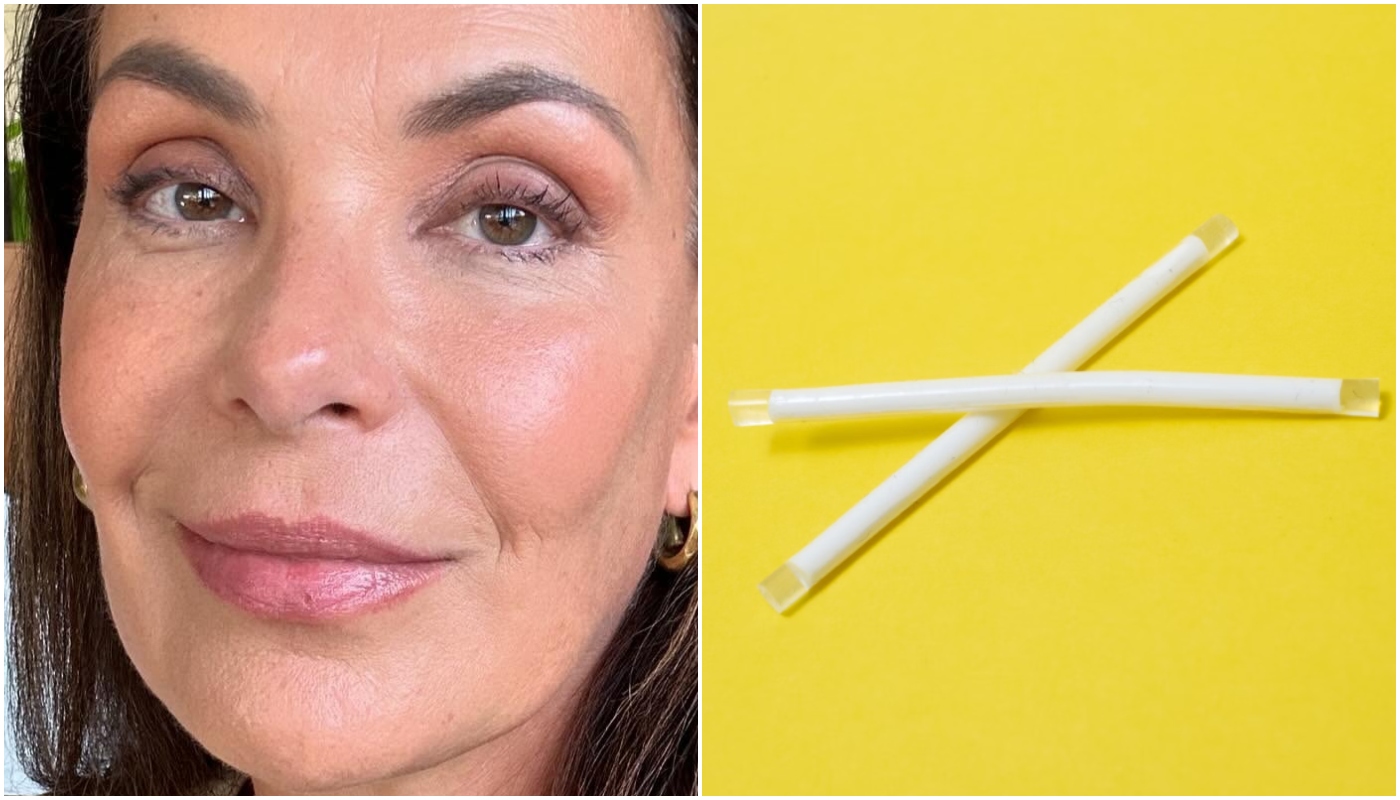 Carolina Ferraz recebeu “chip da beleza” ao buscar reposição hormonal: são a mesma coisa?