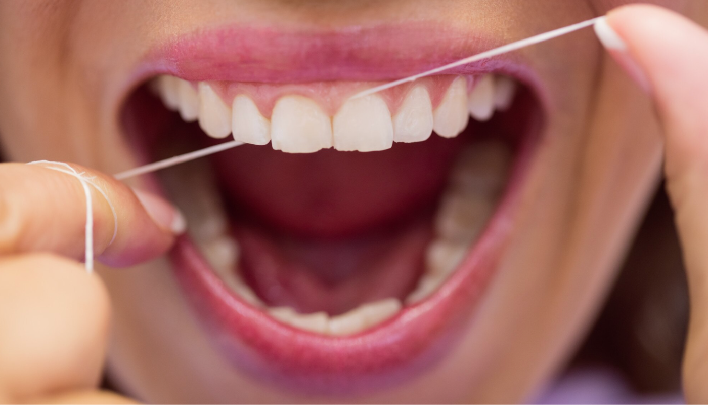 Como passar fio dental do jeito correto: erros comuns e dicas para melhorar a higiene bucal