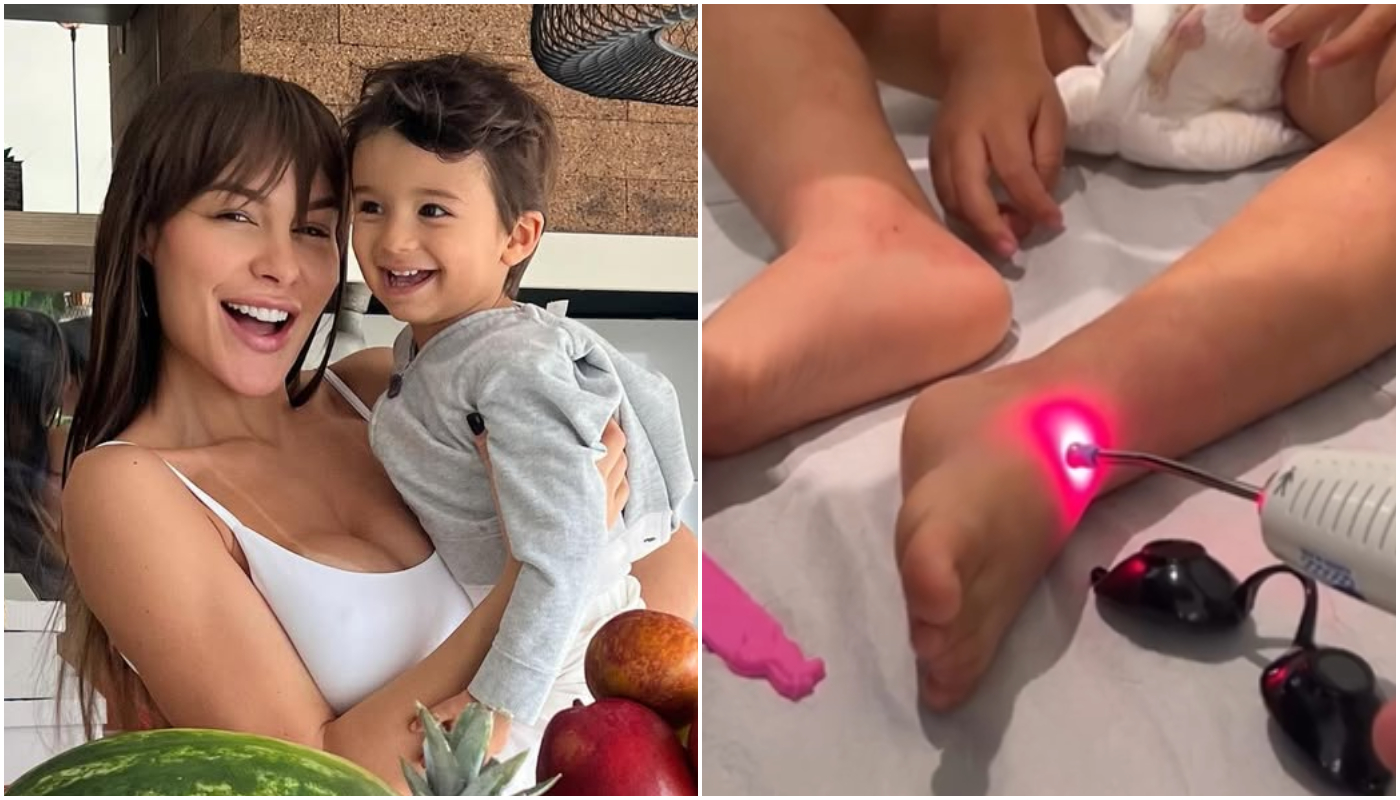 Filho de modelo desenvolve sarna humana após usar roupas novas sem lavar