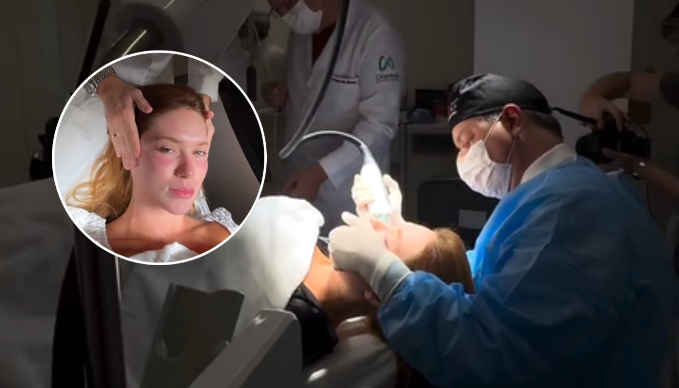 Como é o procedimento para afinar o rosto sem cirurgia de Virginia?