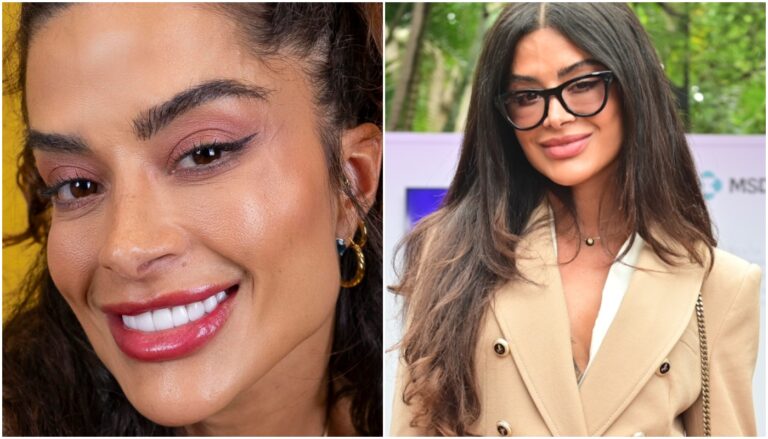 antes e depois de Aline Franco