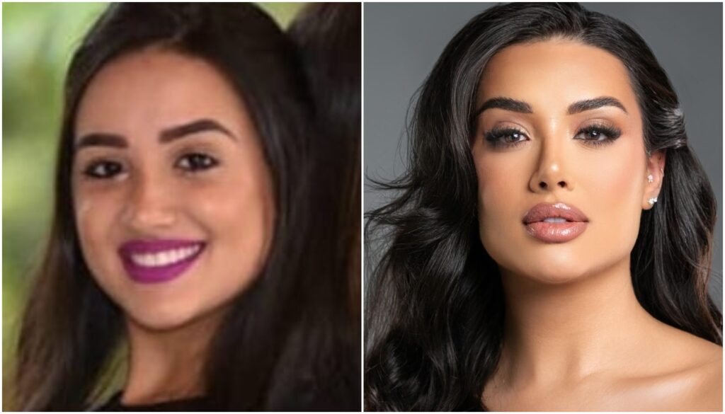 antes e depois de Jordana do BBB26