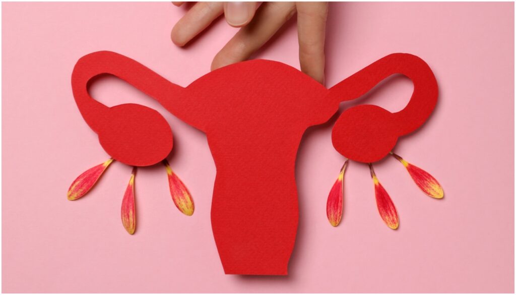 síndrome ovários policísticos