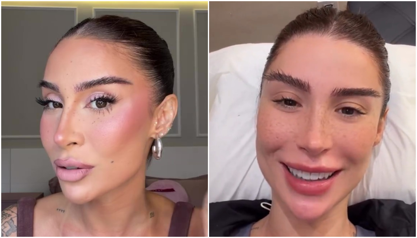Bianca Andrade mostra sobrancelhas “compridas” após transplante: fios não param de crescer?