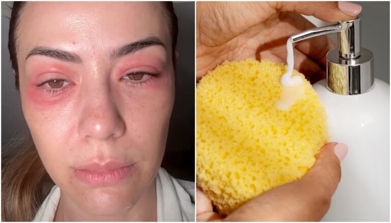 alergia cosmética, taise dias