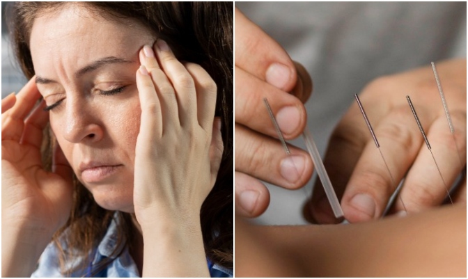 acupuntura-enxaqueca-0426-672x401