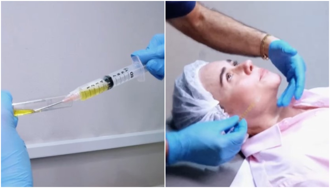 alessandra negrini tratamento