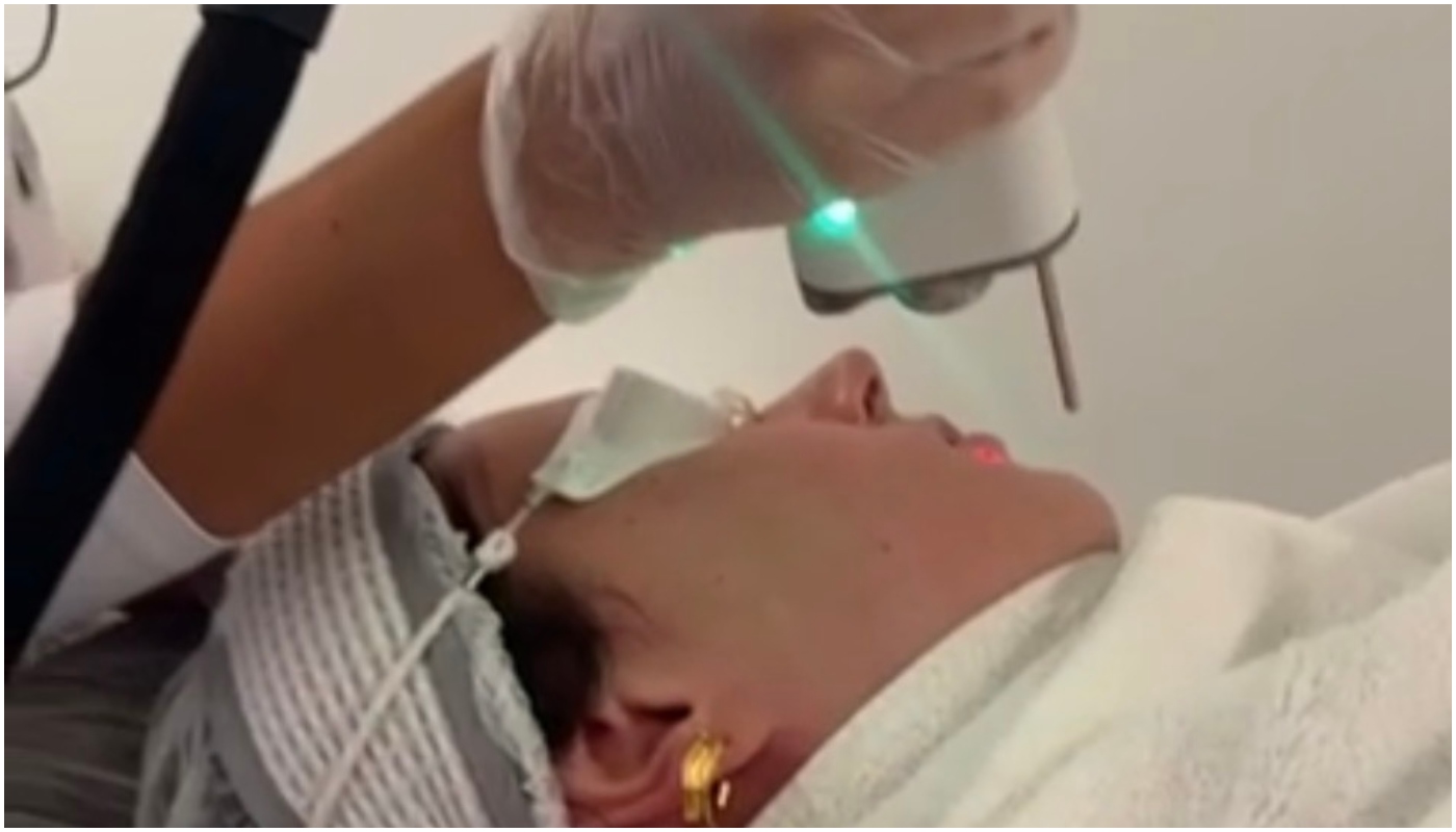 laser fotona