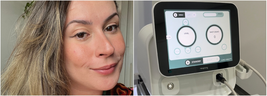 lincurve
