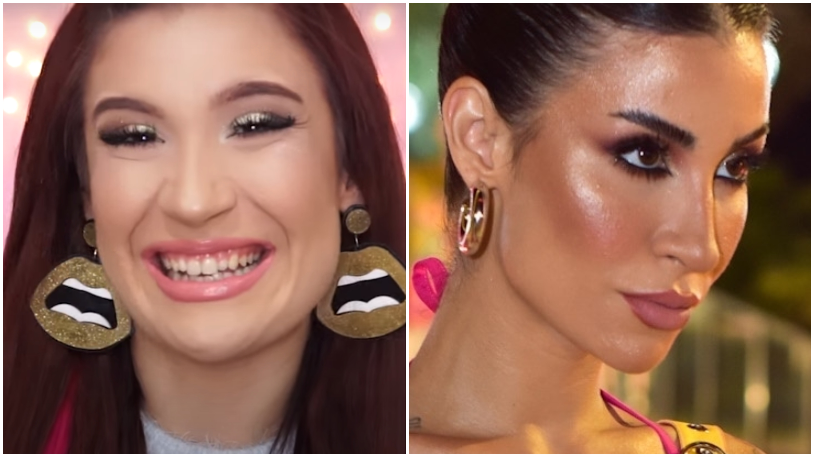 Bianca Andrade antes e depois do preenchimento labial