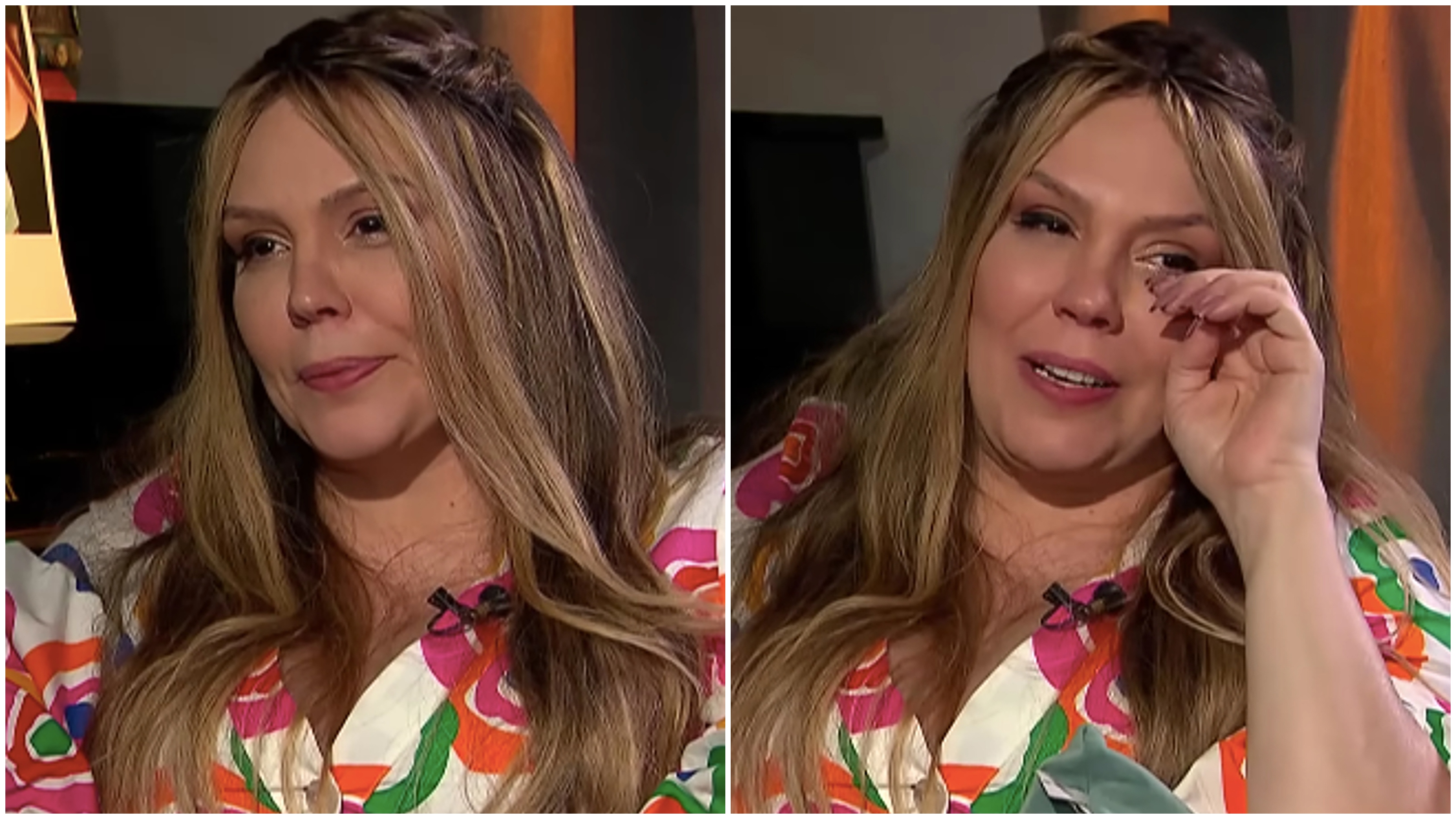 Simony disse ter aceitado a queda capilar, apesar de considerar o momento triste
