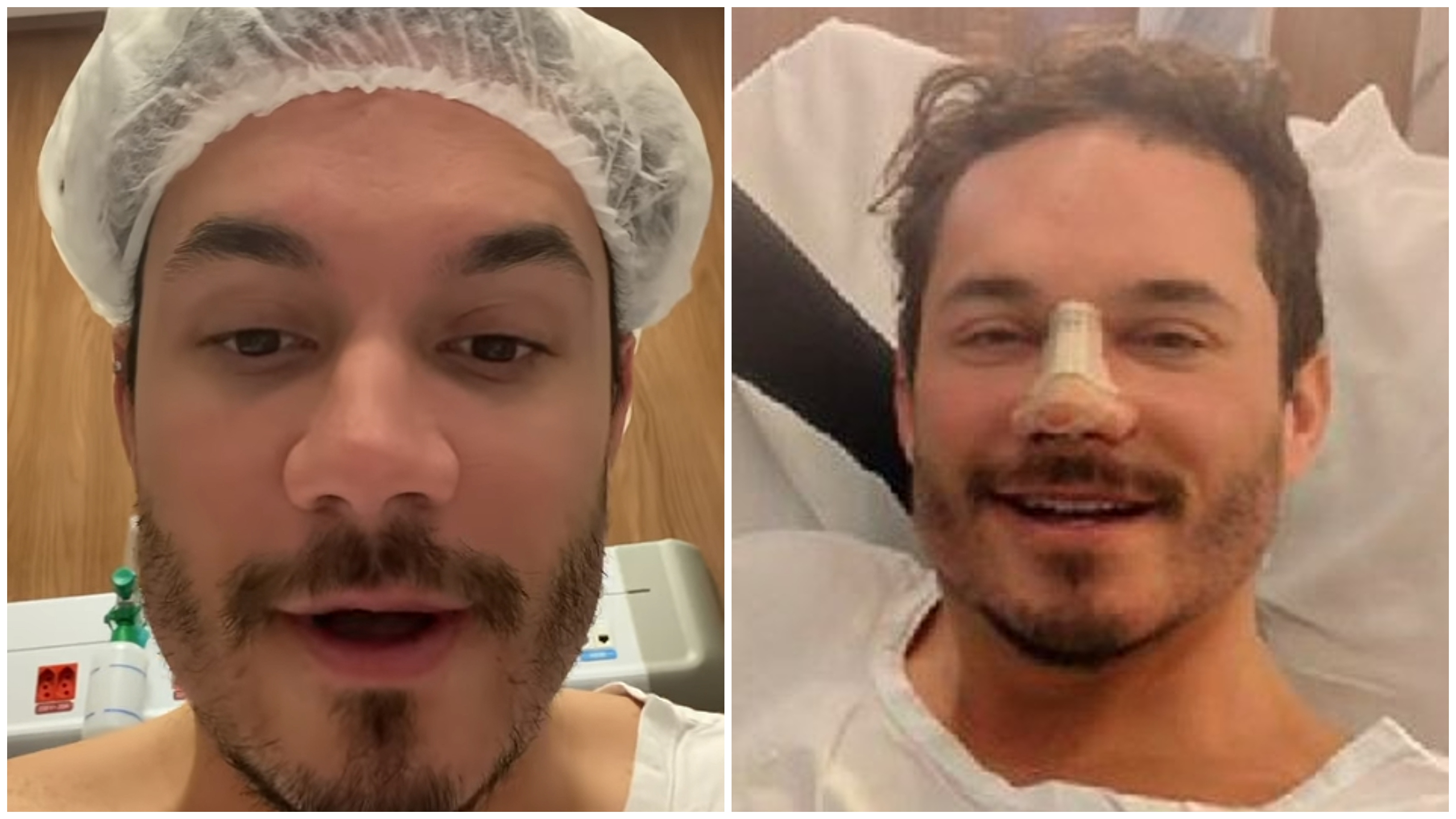 Rinoplastia de Eliezer envolveu razões estéticas e de saúde: veja o resultado da cirurgia