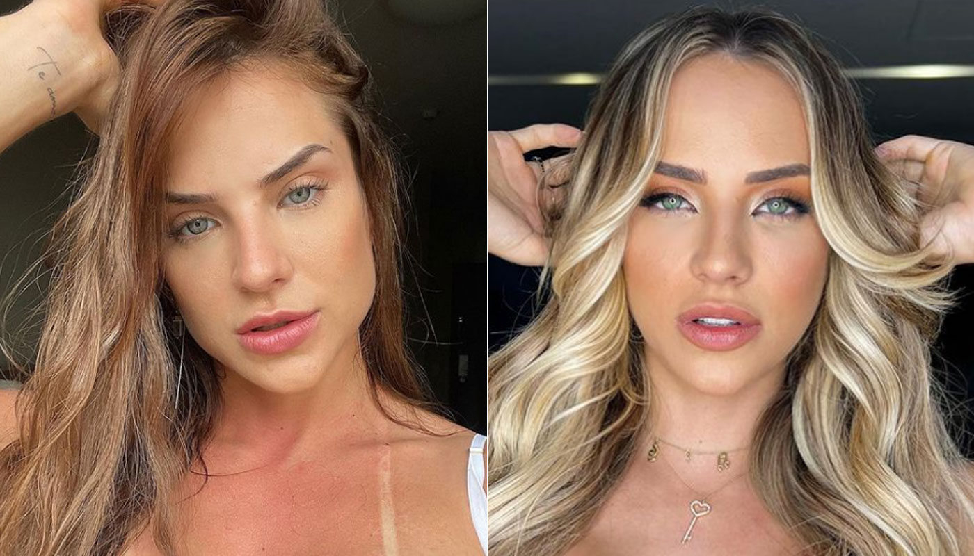 Gabi Martins reverteu harmonização facial