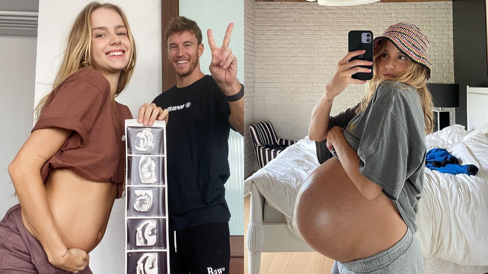 Isabella Scherer dá à luz Mel e Bento: menina foi a primeira a nascer após cesárea