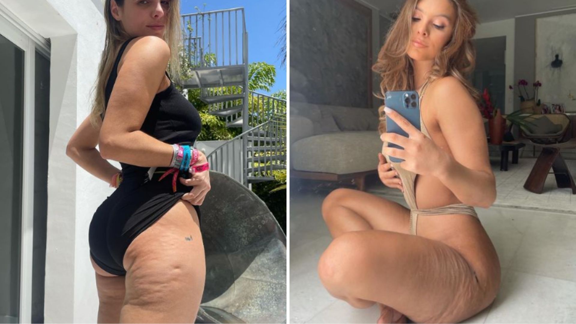 Influencer decide não esconder celulites em todas as fotos: “Aceite e confie em si mesma”