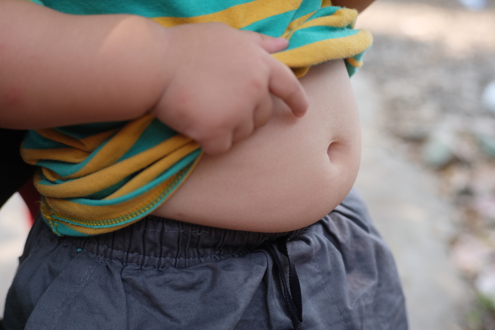 Causa da obesidade infantil nem sempre é má alimentação: especialistas explicam