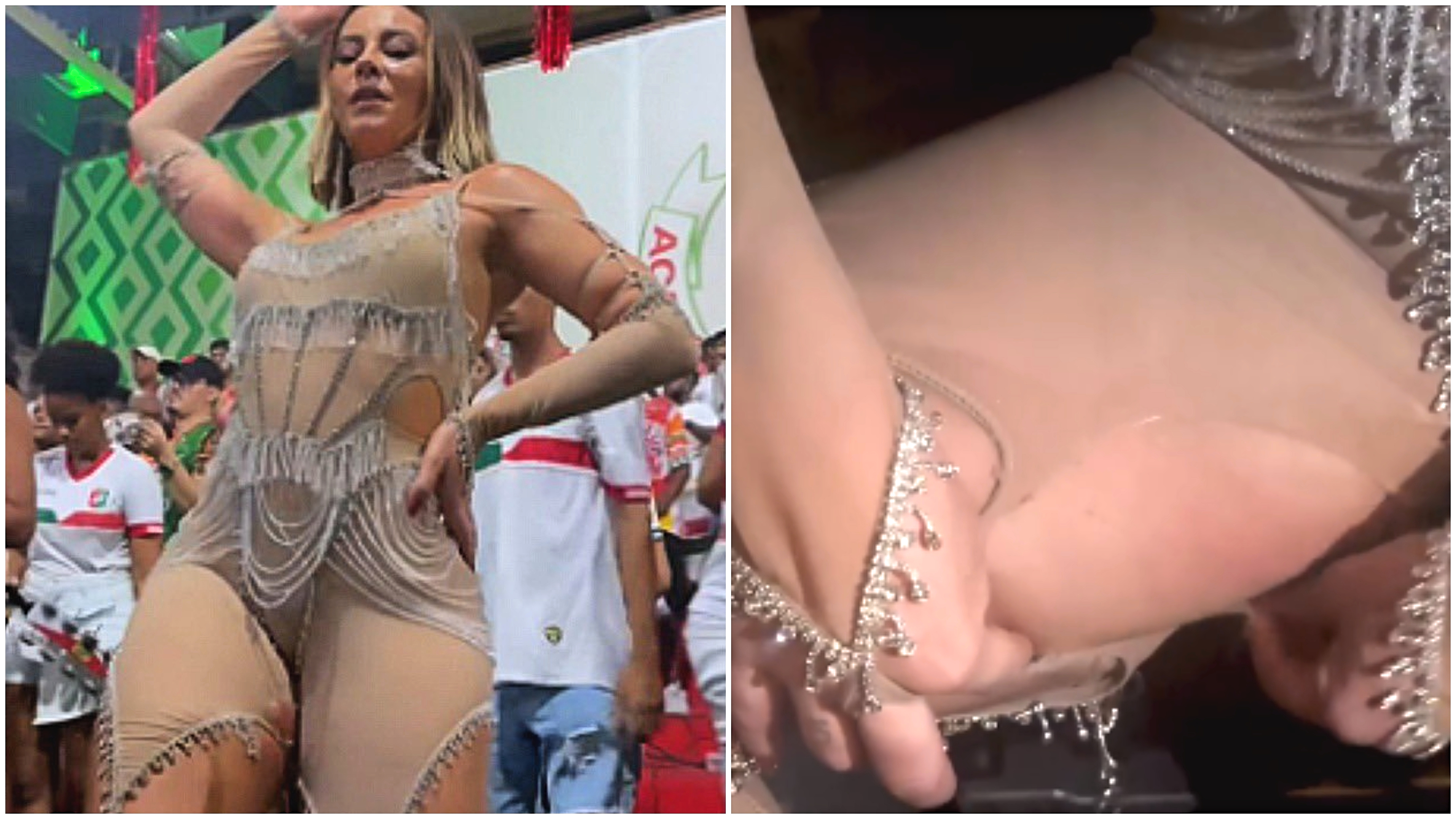 Paolla Oliveira mostra “drama da mulher coxuda” com pele machucada e fãs se identificam